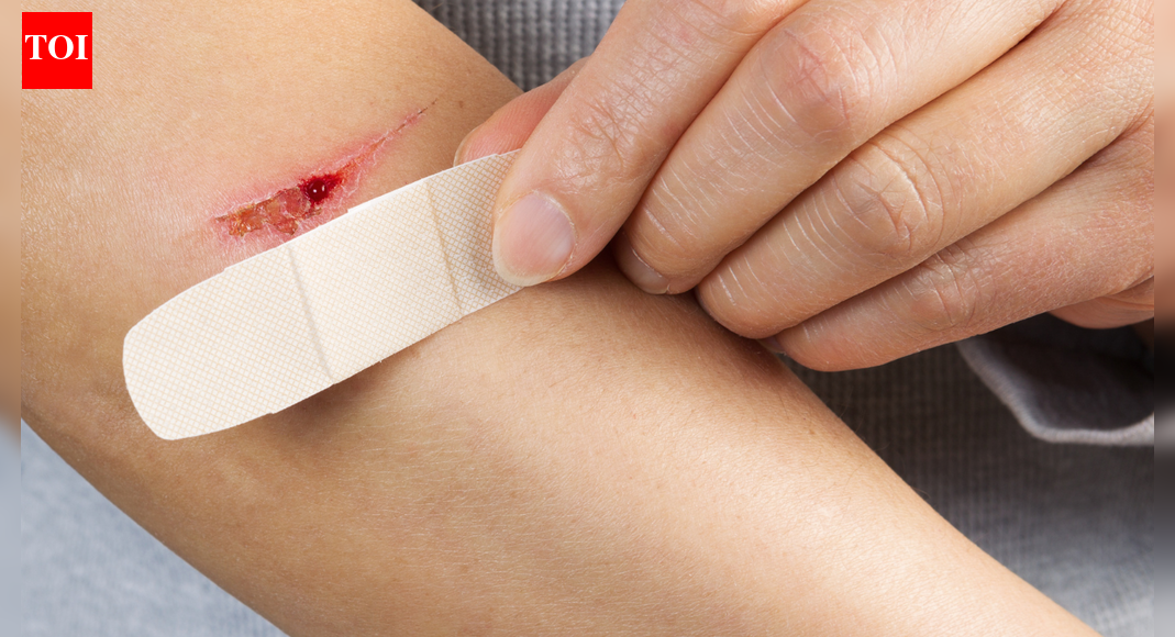 Girl shares why a small, unknown cut on public transport should not be ignored; shares personal experience of getting cut by blade