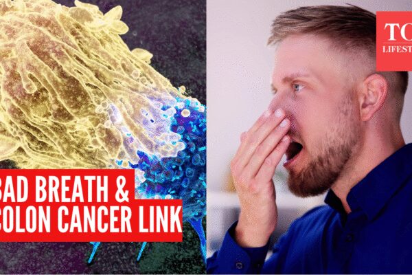 Colon Cancer Symptom: Persistent bad breath could be a warning sign of colon cancer: Gastroenterologist explains the shocking link |