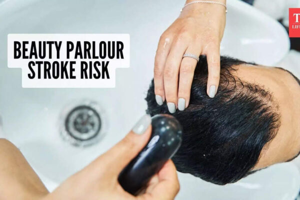 What is beauty parlour stroke syndrome? What are the hidden risks, and how to stay safe |