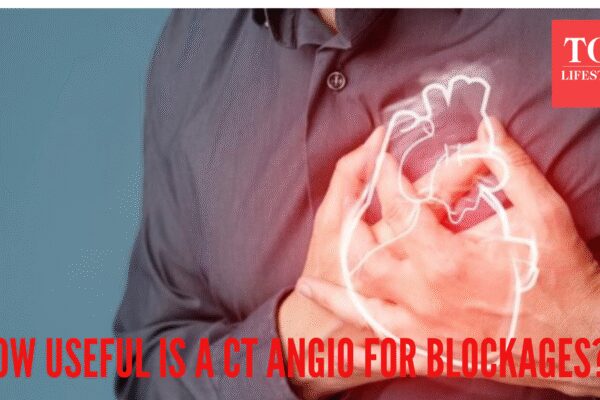 Do you really need a CT Angiography to detect heart blockages? Leading doctor busts some myths