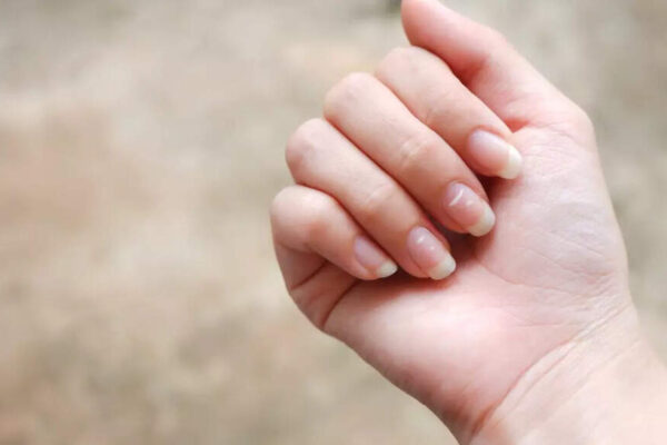 5 warning signs on nails you should not ignore