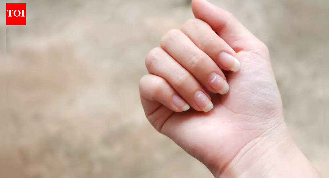 5 warning signs on nails you should not ignore