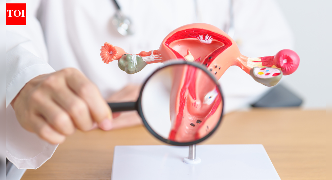 Can cervical cancer really be prevented before it starts? Five key answers every woman should know