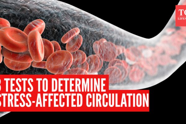 Vascular surgeon shares 3 tests to find out if stress is affecting your circulation