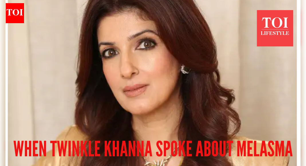 When Twinkle Khanna opened up on melasma, calling it a ‘bin bulaya mehman’: here’s what we know on the condition