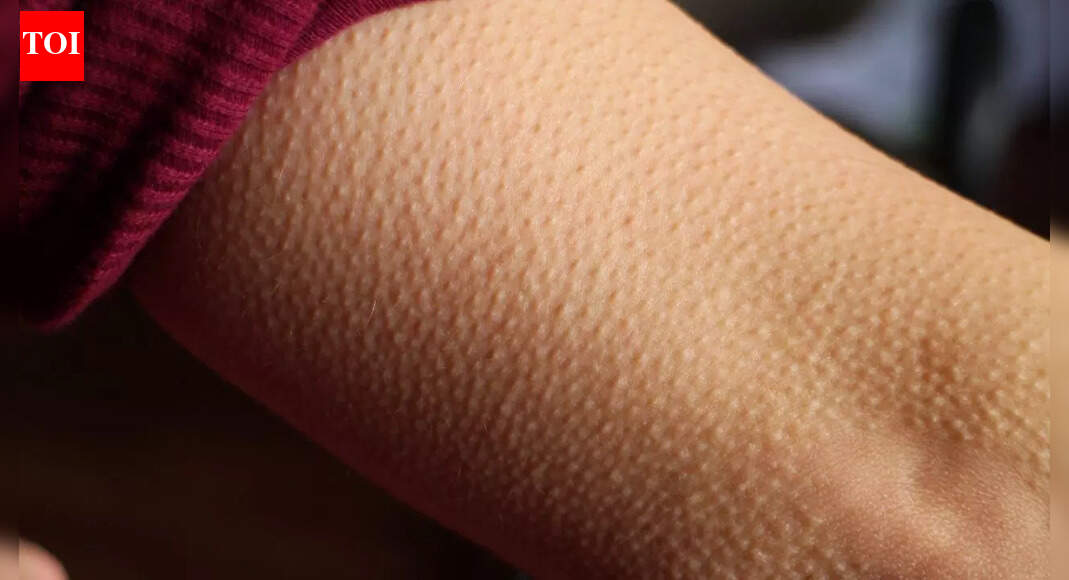 This ‘useless’ body part explains why humans get goosebumps and its surprising role in skin and hair health |