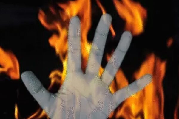 19-year-old set afire in front of college | India News