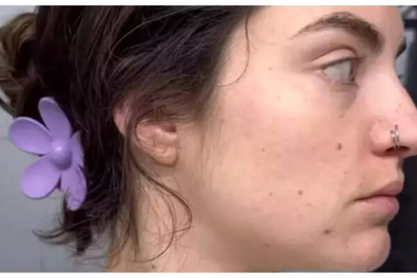 Woman quits alcohol for 30 days, shares her amazing skin transformation; ‘Breaking a habit is hard….’
