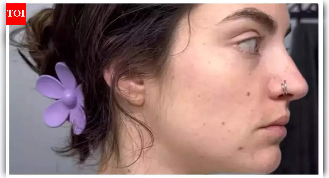 Woman quits alcohol for 30 days, shares her amazing skin transformation; ‘Breaking a habit is hard….’