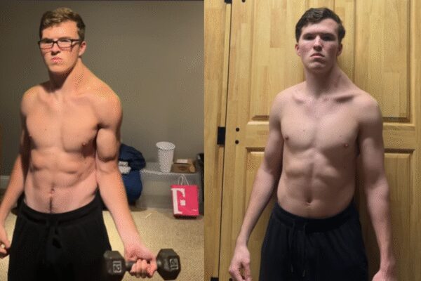 Extreme asymmetry: Doctors warn after influencer spends 300 days training only one shoulder |