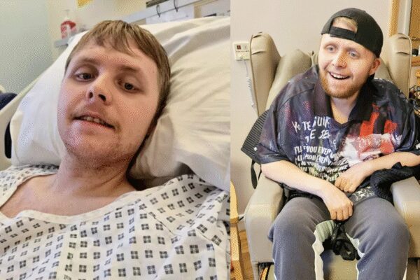 UK’s youngest dementia patient dies at 24; doctors say he had the brain of a 70-year-old |