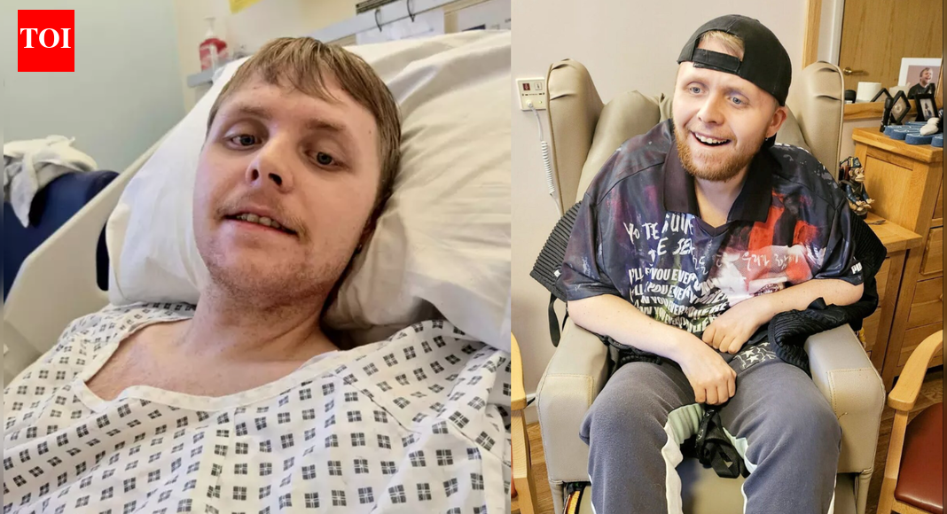 UK’s youngest dementia patient dies at 24; doctors say he had the brain of a 70-year-old |