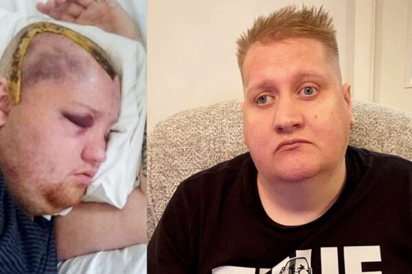 ‘It’s a nightmare’: UK man sues NHS after receiving eight years of chemotherapy instead of six months |