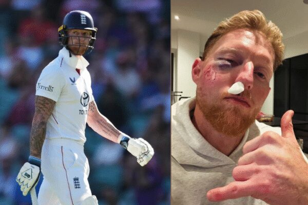 England Test captain Ben Stokes left bloodied after brutal facial injury