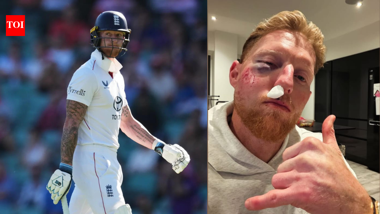 England Test captain Ben Stokes left bloodied after brutal facial injury