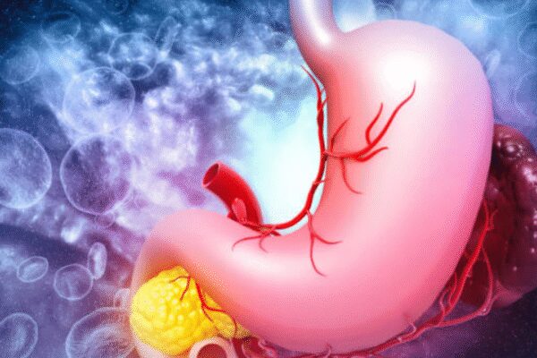Gurugram man with rare gastrointestinal stromal tumor, dangerously low BP underwent successful robotic surgery